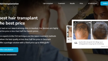 Cheap Hair Transplantation Reviews
