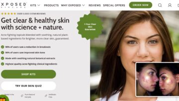 Exposed-Skincare-Review